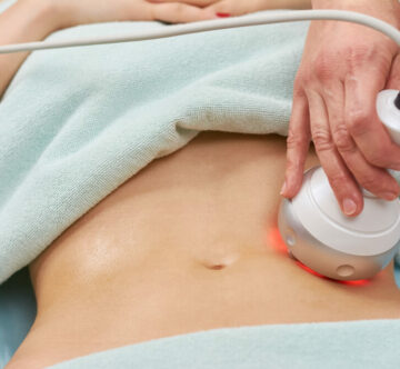 Ook bekend als lichaamscontouring